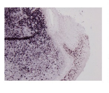 MSH6 Rabbit Polyclonal Antibody