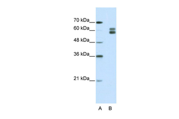MSH2 Rabbit Polyclonal Antibody