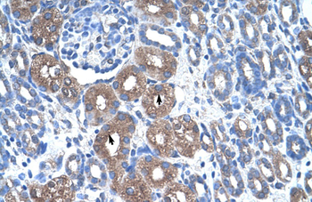 ASS Rabbit Polyclonal Antibody