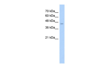 ASS Rabbit Polyclonal Antibody