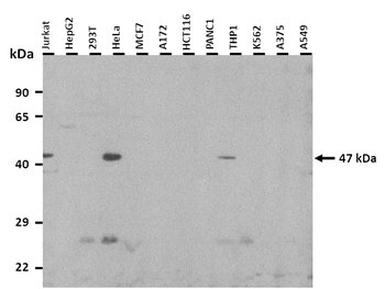 ASS Rabbit Polyclonal Antibody