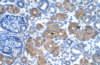 ASS Rabbit Polyclonal Antibody