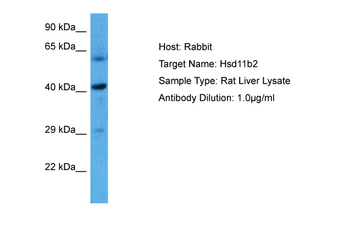 HSD11B2 Rabbit Polyclonal Antibody
