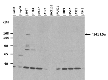 MYBPC3 Rabbit Polyclonal Antibody