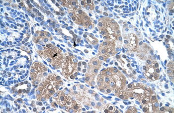 FBP1 Rabbit Polyclonal Antibody