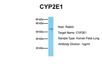 CYP2E1 Rabbit Polyclonal Antibody