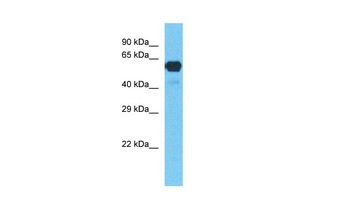 CYP2E1 Rabbit Polyclonal Antibody