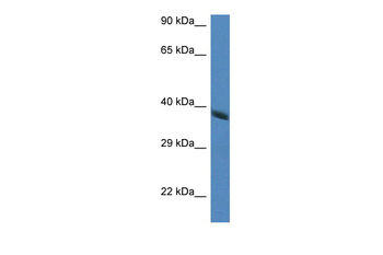Hao2 Rabbit Polyclonal Antibody