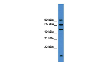 UMOD Rabbit Polyclonal Antibody