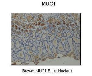 MUC1 Rabbit Polyclonal Antibody