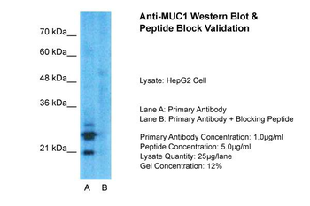 MUC1 Rabbit Polyclonal Antibody