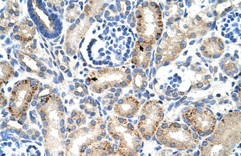 MUC1 Rabbit Polyclonal Antibody