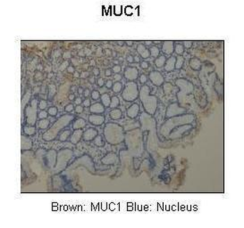 MUC1 Rabbit Polyclonal Antibody