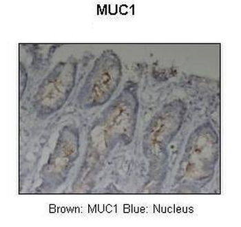 MUC1 Rabbit Polyclonal Antibody