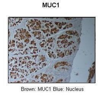 MUC1 Rabbit Polyclonal Antibody