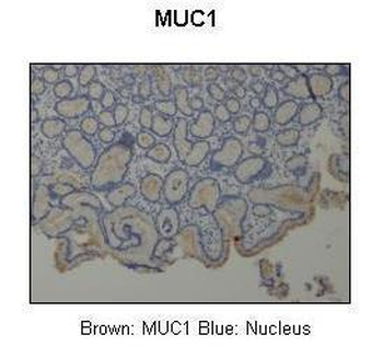MUC1 Rabbit Polyclonal Antibody