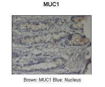 MUC1 Rabbit Polyclonal Antibody