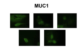 MUC1 Rabbit Polyclonal Antibody