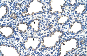 EMP2 Rabbit Polyclonal Antibody