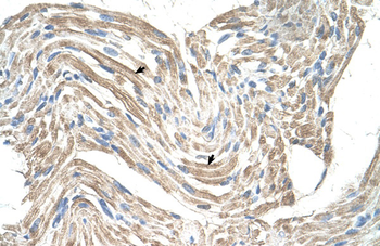 CKMT2 Rabbit Polyclonal Antibody
