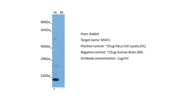 MUC1 Rabbit Polyclonal Antibody