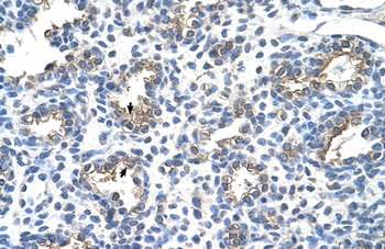 CEACAM6 Rabbit Polyclonal Antibody