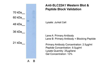 SLC22A1 Rabbit Polyclonal Antibody