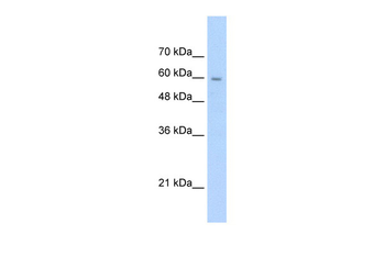 SLC22A1 Rabbit Polyclonal Antibody