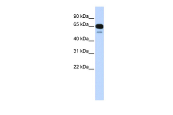 SLC22A8 Rabbit Polyclonal Antibody