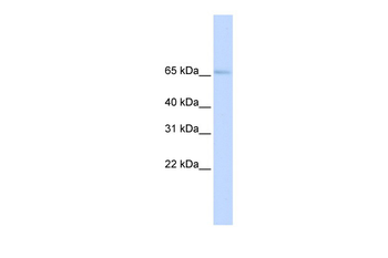 SLC22A6 Rabbit Polyclonal Antibody