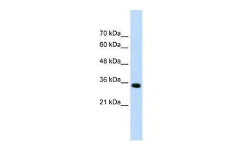 ADAMTS4 Rabbit Polyclonal Antibody