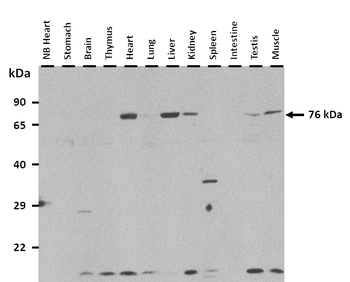 Masp2 Rabbit Polyclonal Antibody