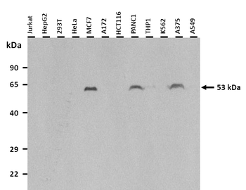 MARCO Rabbit Polyclonal Antibody