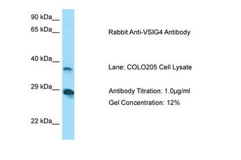 VSIG4 Rabbit Polyclonal Antibody