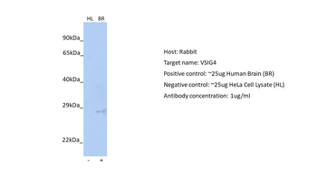 VSIG4 Rabbit Polyclonal Antibody