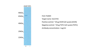 SLC27A5 Rabbit Polyclonal Antibody