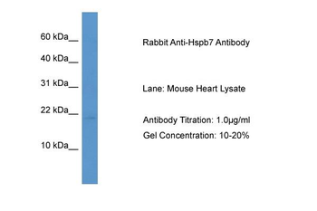 Hspb7 Rabbit Polyclonal Antibody