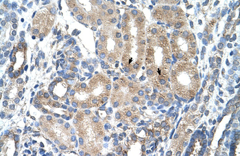 AGER Rabbit Polyclonal Antibody