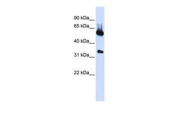 ALAS2 Rabbit Polyclonal Antibody
