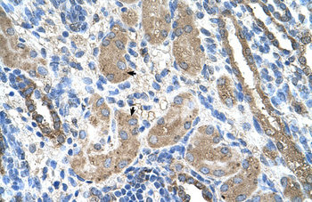 CYP2D6 Rabbit Polyclonal Antibody
