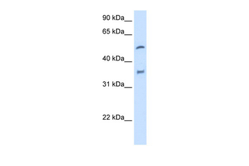 CYP2D6 Rabbit Polyclonal Antibody