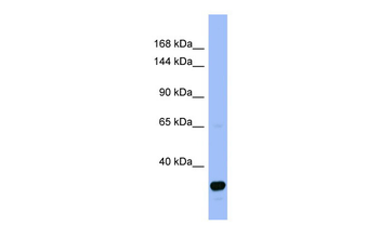FANCA Rabbit Polyclonal Antibody