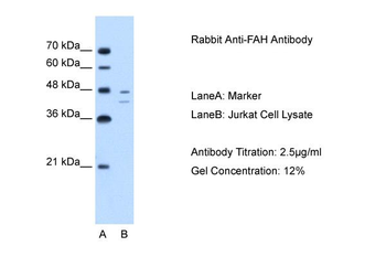 FAH Rabbit Polyclonal Antibody