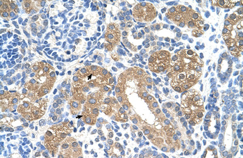 FAH Rabbit Polyclonal Antibody