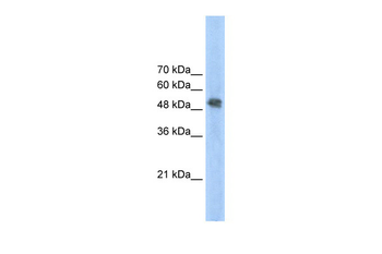 FECH Rabbit Polyclonal Antibody