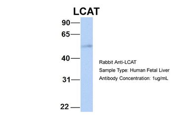 LCAT Rabbit Polyclonal Antibody