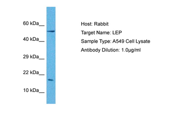 LEP Rabbit Polyclonal Antibody