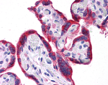 LEP Rabbit Polyclonal Antibody