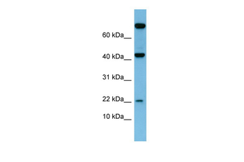 LEP Rabbit Polyclonal Antibody