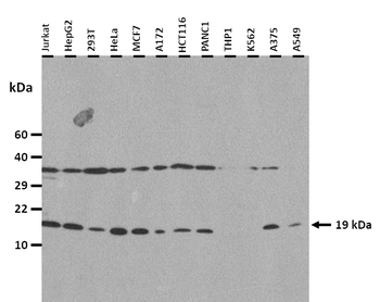 LEP Rabbit Polyclonal Antibody